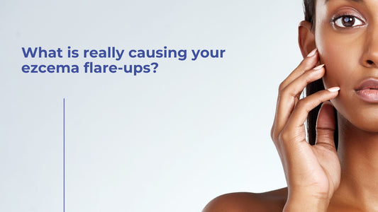 Image of woman touching her face. A question on the image reads "What is really causing your eczema flare-ups?"