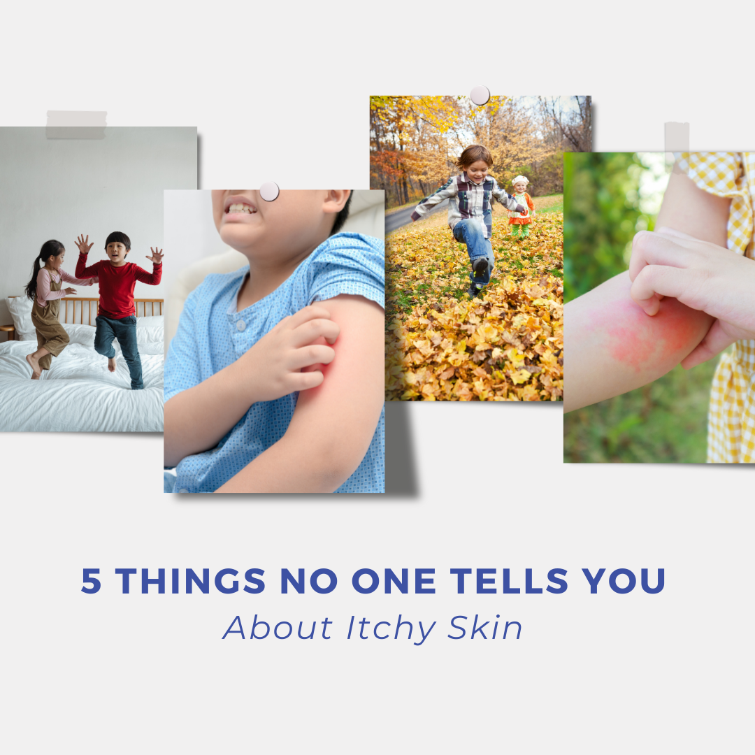 5 Things No One Tells You About Itchy Skin