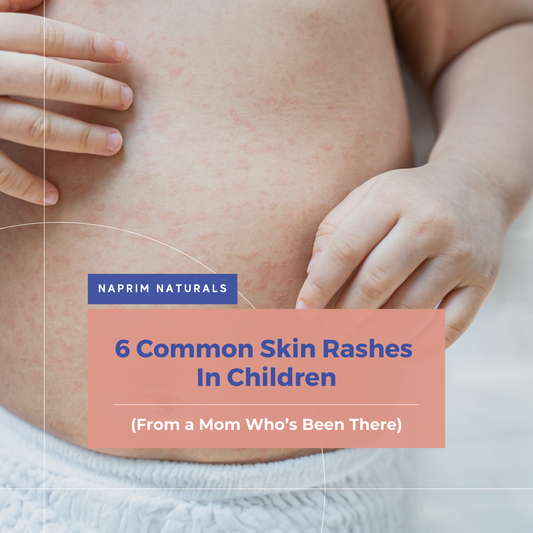 6 Common Skin Rashes in Children (From a Mom Who’s Been There)