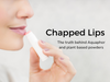 The Truth About Chapped Lips: Why Vaseline chapstick and Aquaphor Fall Short