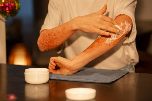 The Role of Natural Powders in Treating Skin Irritations Faster Than Traditional Products